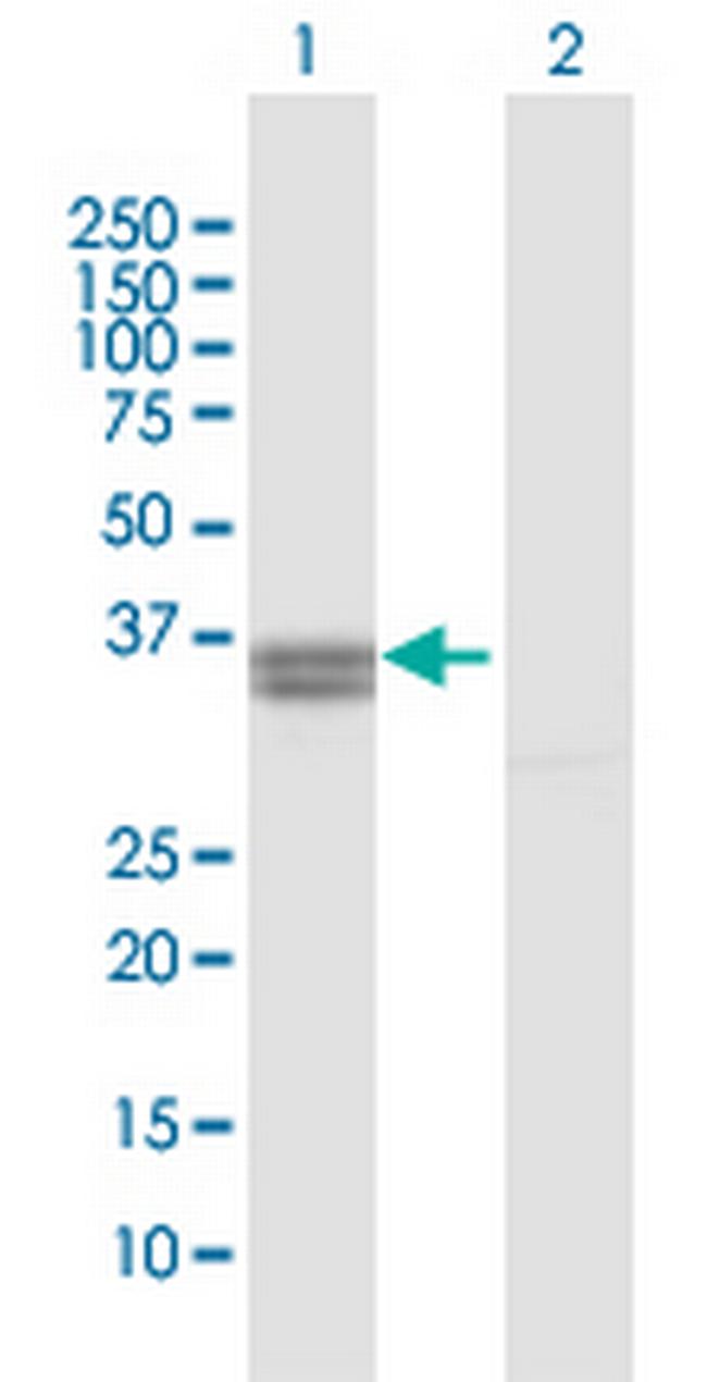 PPA2 Antibody in Western Blot (WB)