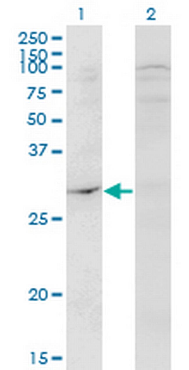 DAPP1 Antibody in Western Blot (WB)