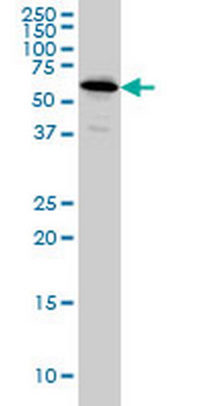 NDOR1 Antibody in Western Blot (WB)