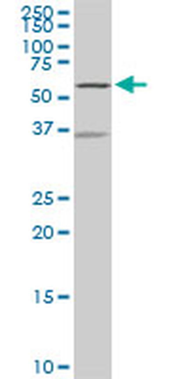 NDOR1 Antibody in Western Blot (WB)