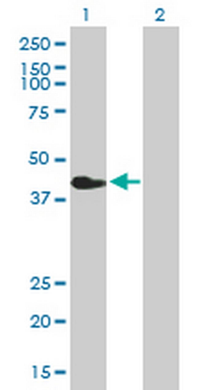 CHIA Antibody in Western Blot (WB)