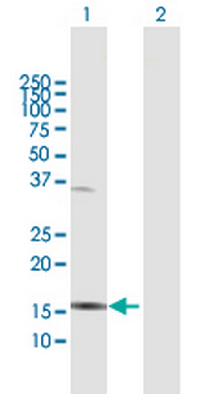 IL1F6 Antibody in Western Blot (WB)