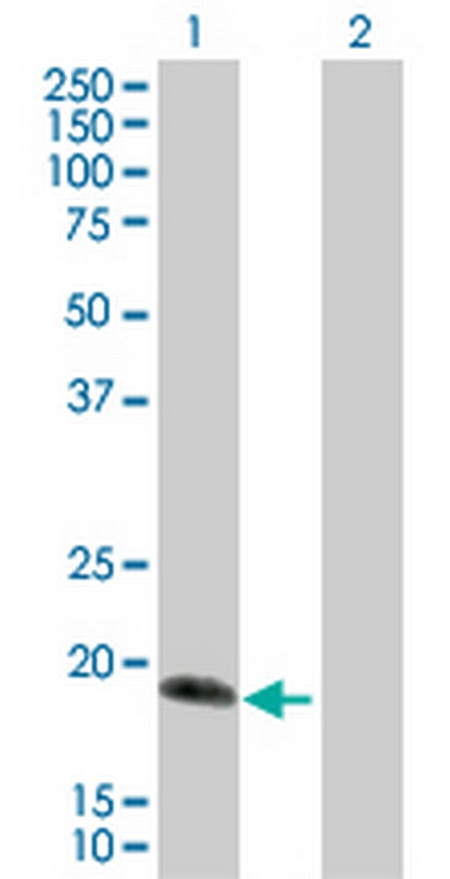 IL17C Antibody in Western Blot (WB)