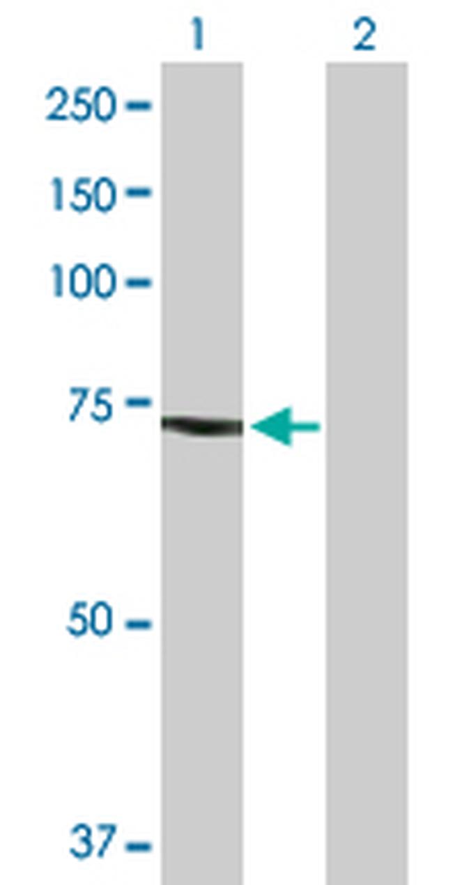 TUBGCP4 Antibody in Western Blot (WB)