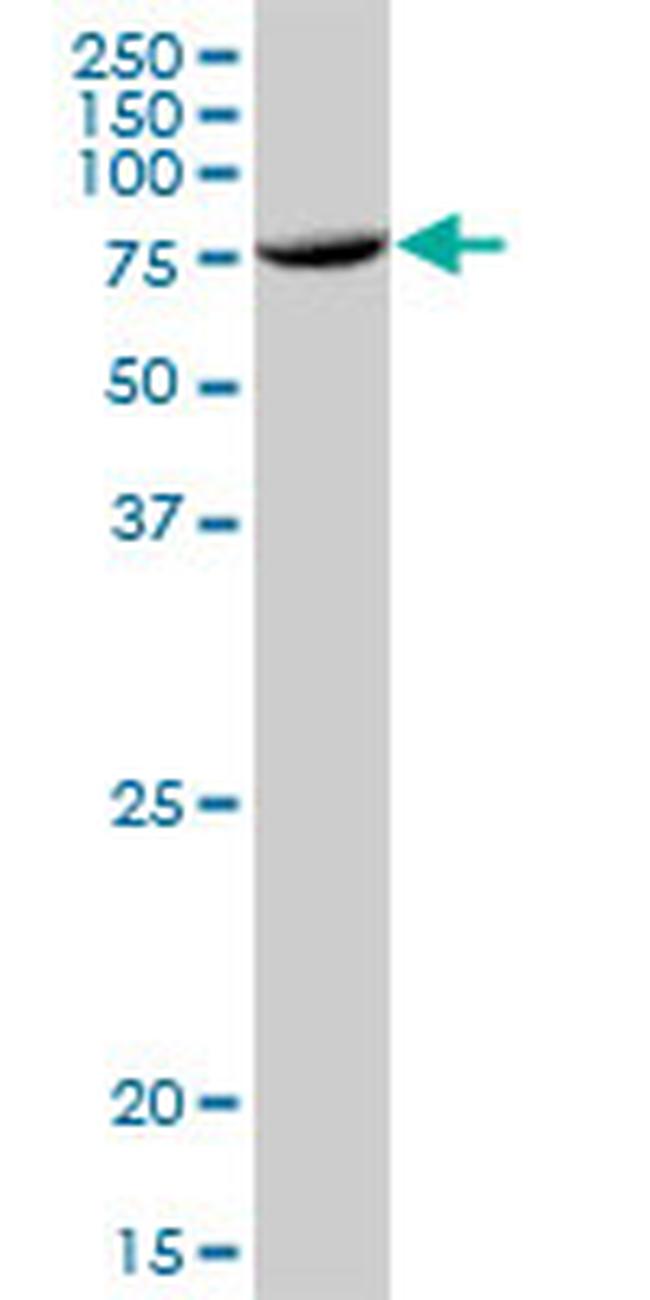 TUBGCP4 Antibody in Western Blot (WB)