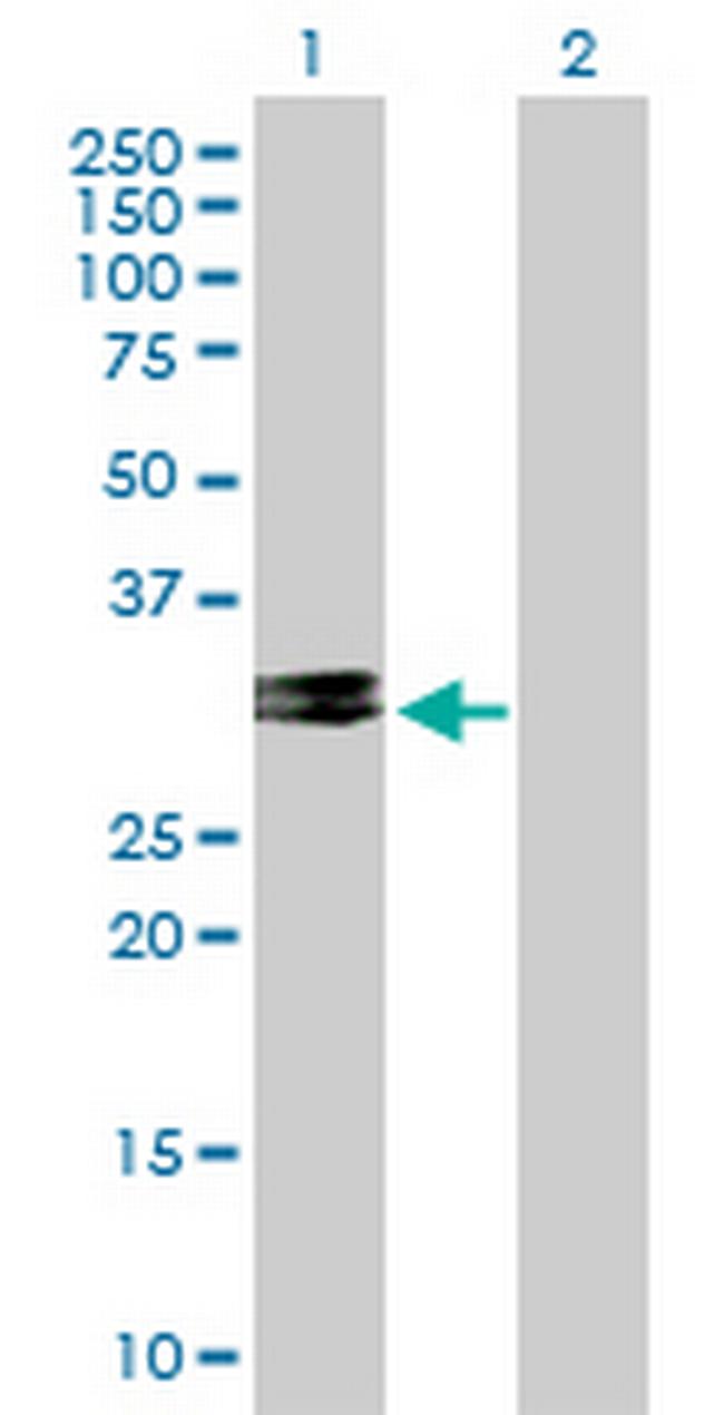 CHMP2A Antibody in Western Blot (WB)