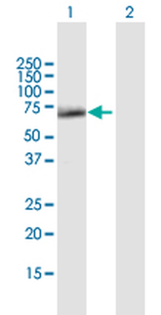 SESN1 Antibody in Western Blot (WB)