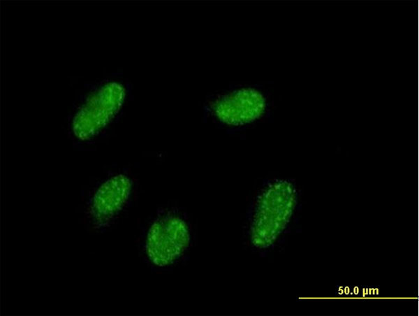 VENTX Antibody in Immunocytochemistry (ICC/IF)