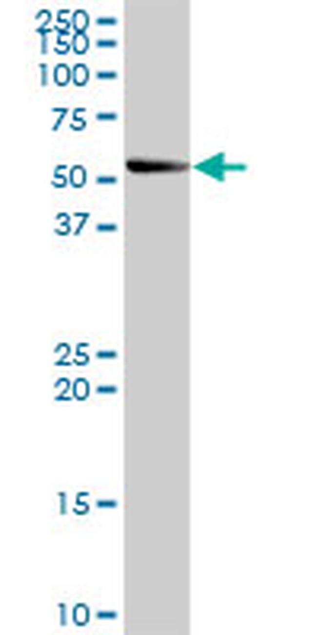 SMPDL3B Antibody in Western Blot (WB)