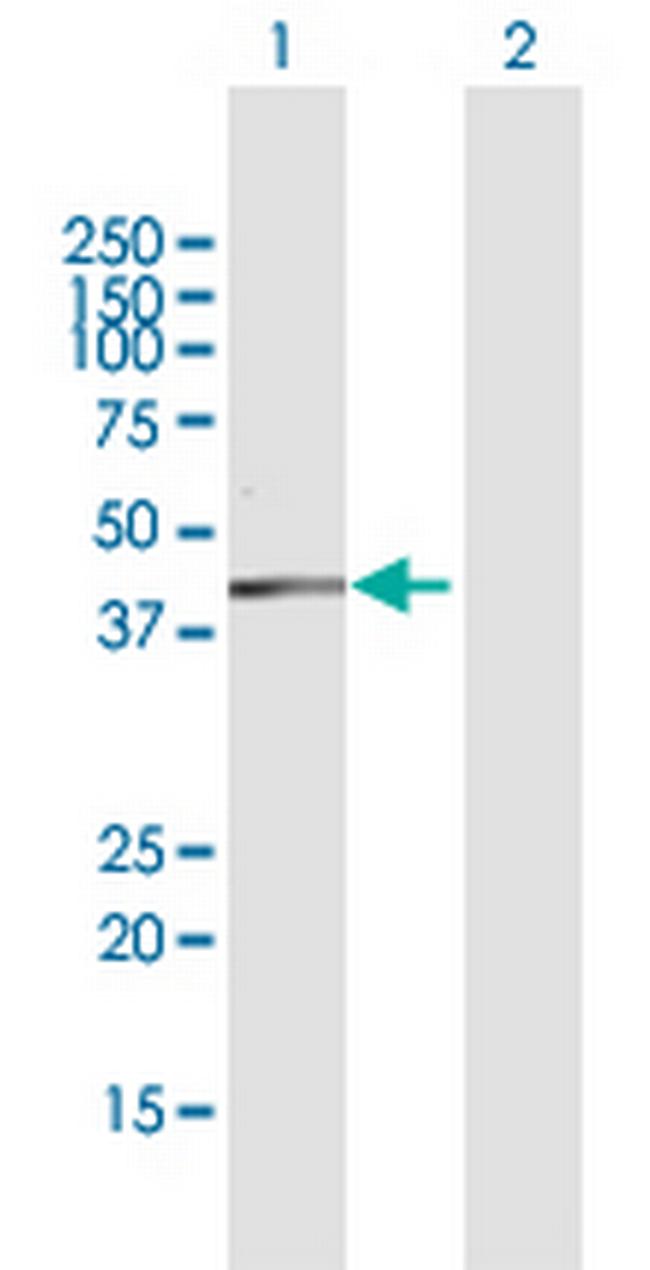 DHDH Antibody in Western Blot (WB)