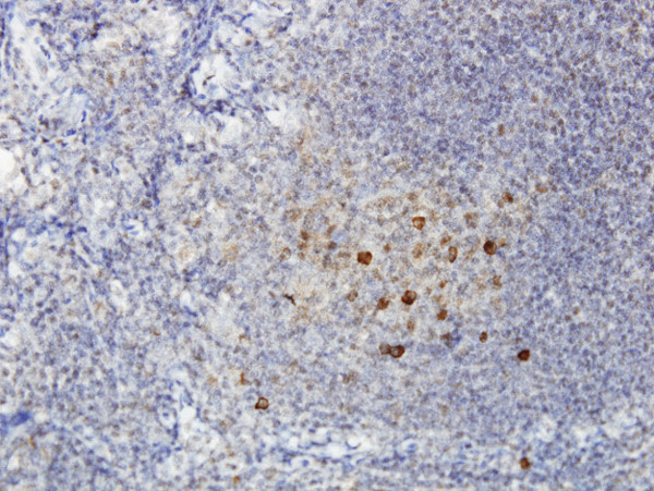 ADAMDEC1 Antibody in Immunohistochemistry (Paraffin) (IHC (P))