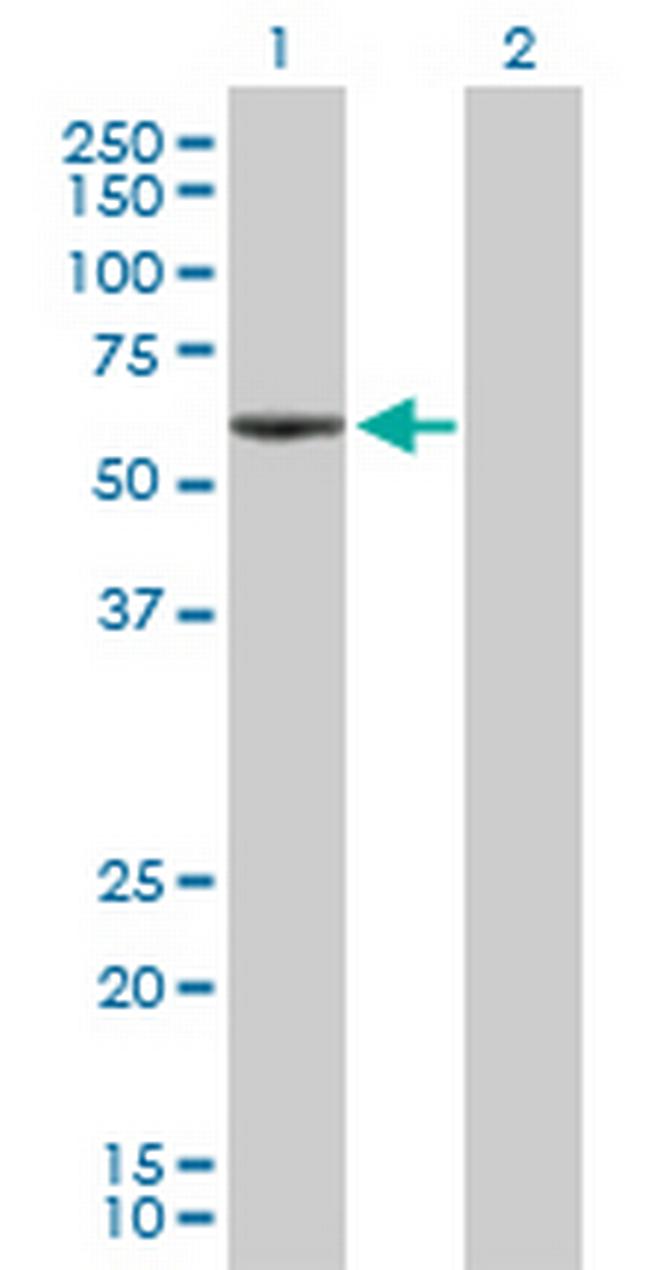 ANGPTL3 Antibody in Western Blot (WB)