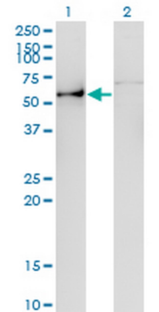 ANGPTL3 Antibody in Western Blot (WB)