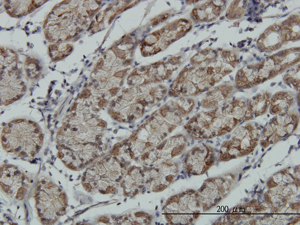 RPS6KA6 Antibody in Immunohistochemistry (Paraffin) (IHC (P))