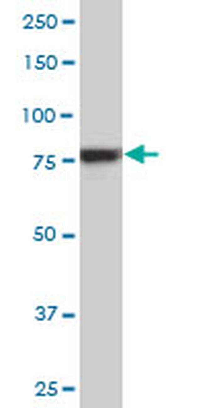 RPS6KA6 Antibody in Western Blot (WB)