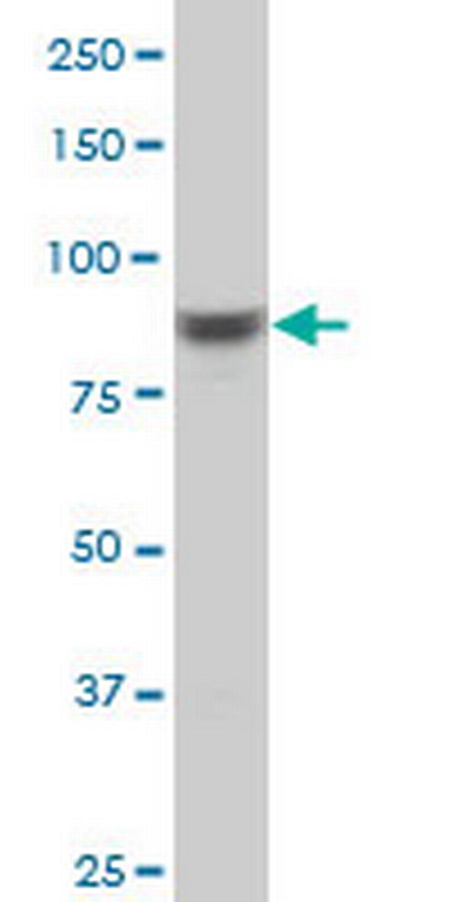 RPS6KA6 Antibody in Western Blot (WB)