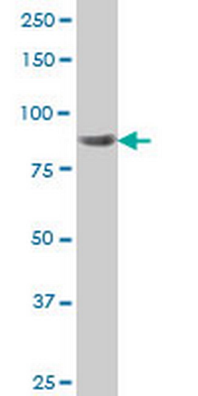 RPS6KA6 Antibody in Western Blot (WB)