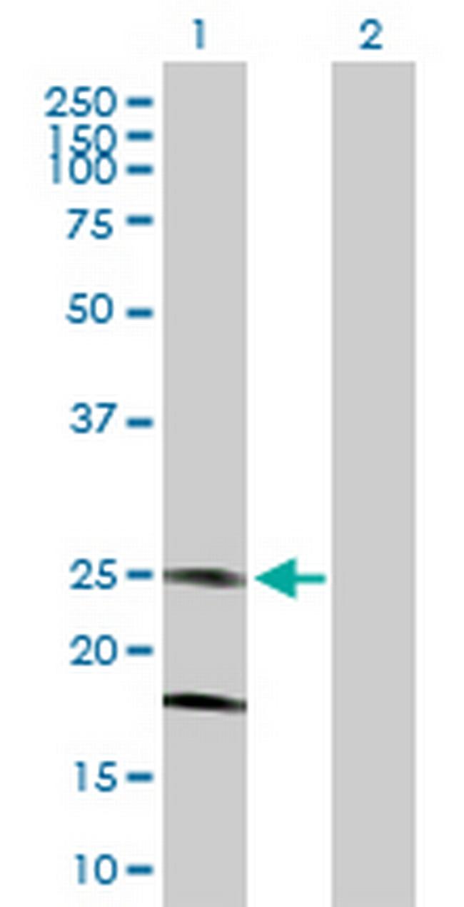 KCNMB4 Antibody in Western Blot (WB)