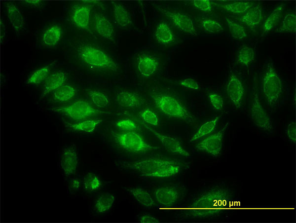 HTRA2 Antibody in Immunocytochemistry (ICC/IF)