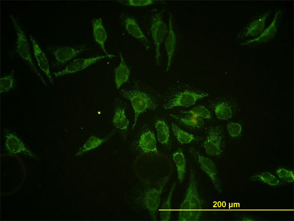 HTRA2 Antibody in Immunocytochemistry (ICC/IF)