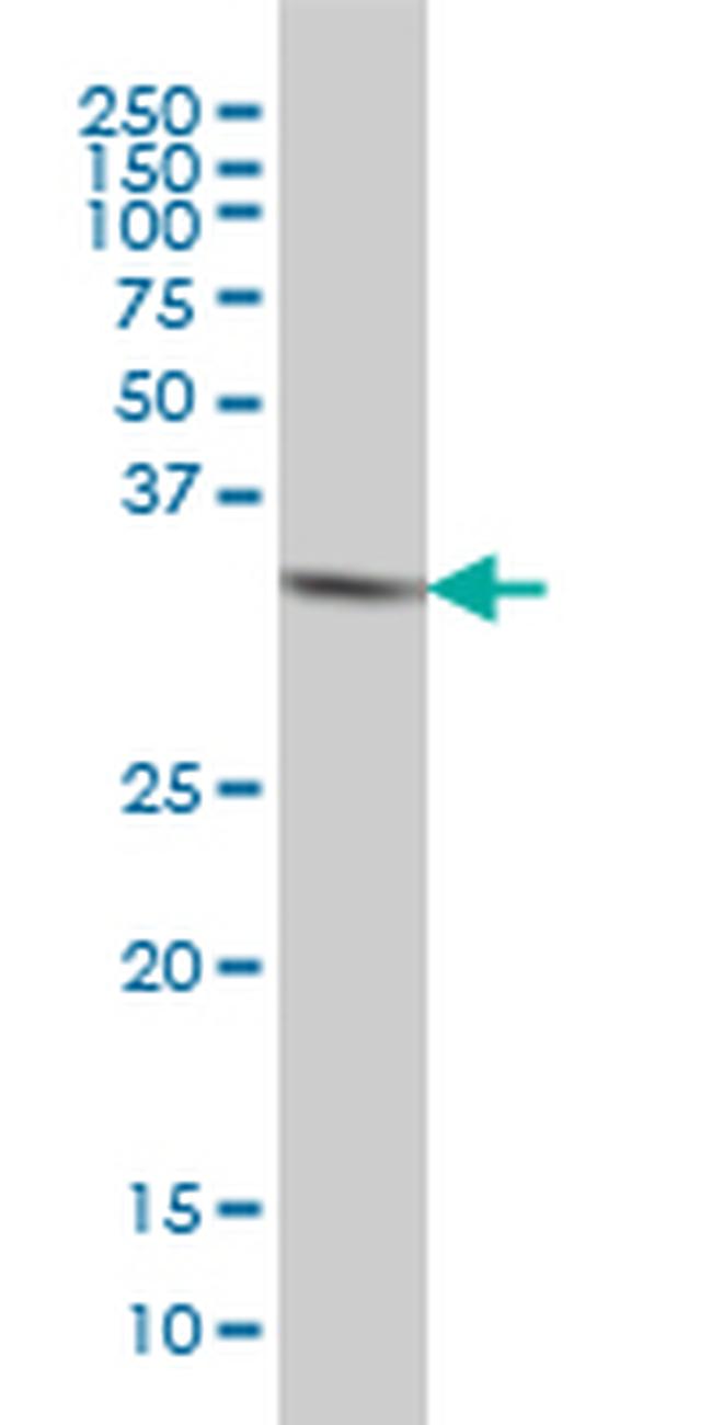 HTRA2 Antibody in Western Blot (WB)