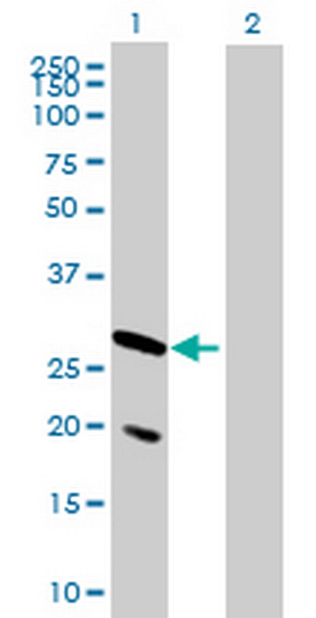 IGLV4-3 Antibody in Western Blot (WB)