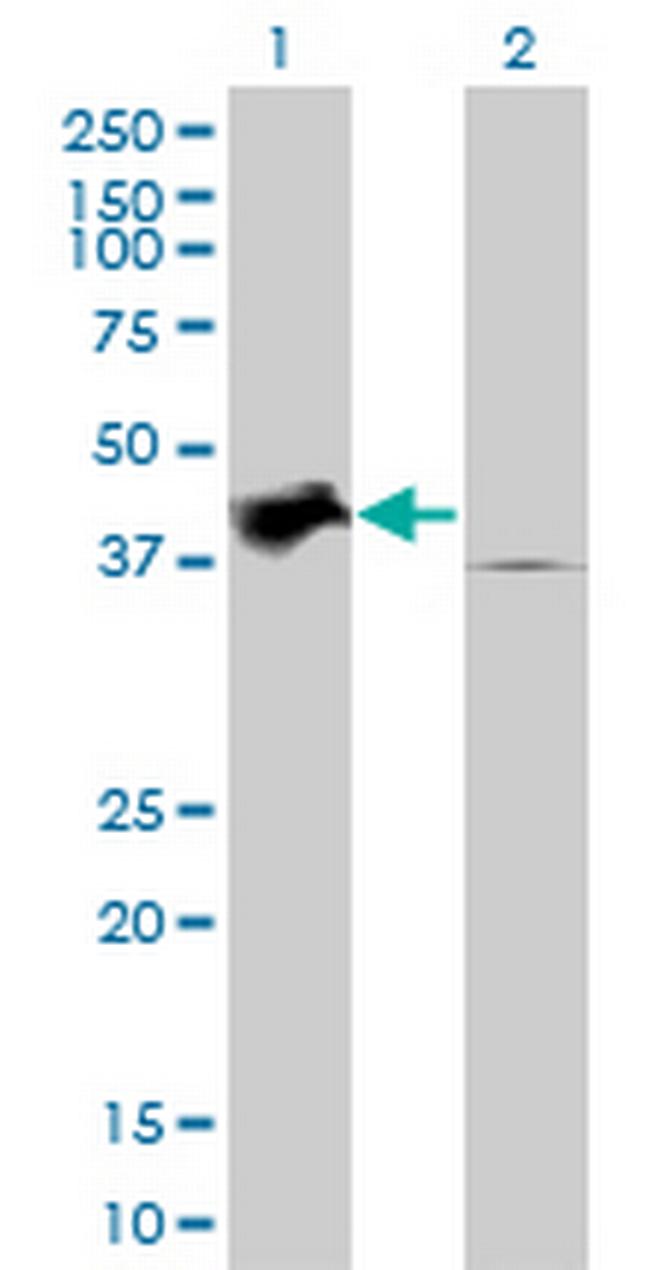 TRIB2 Antibody in Western Blot (WB)