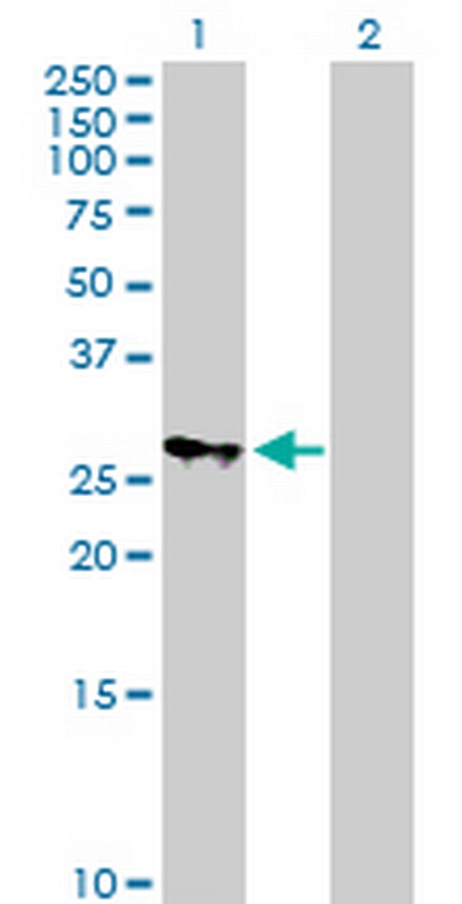 MRPS18B Antibody in Western Blot (WB)