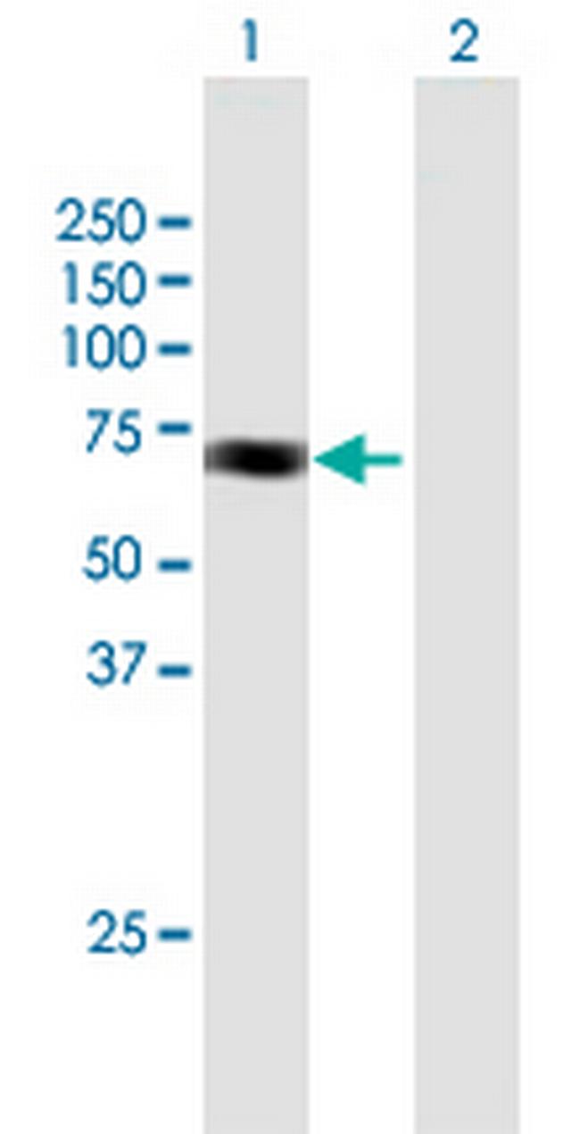 ACAD9 Antibody in Western Blot (WB)