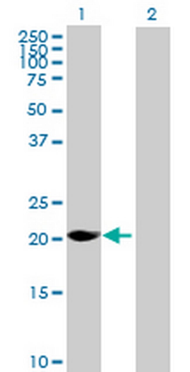 MAGEH1 Antibody in Western Blot (WB)