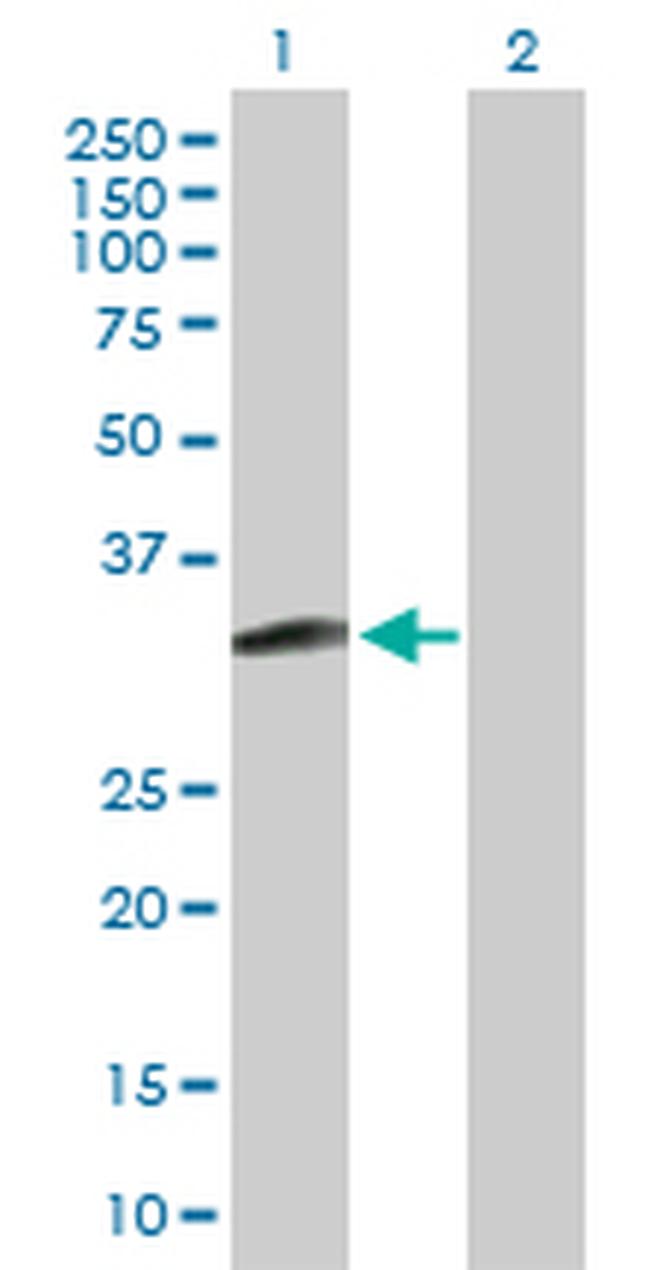 MAGEH1 Antibody in Western Blot (WB)