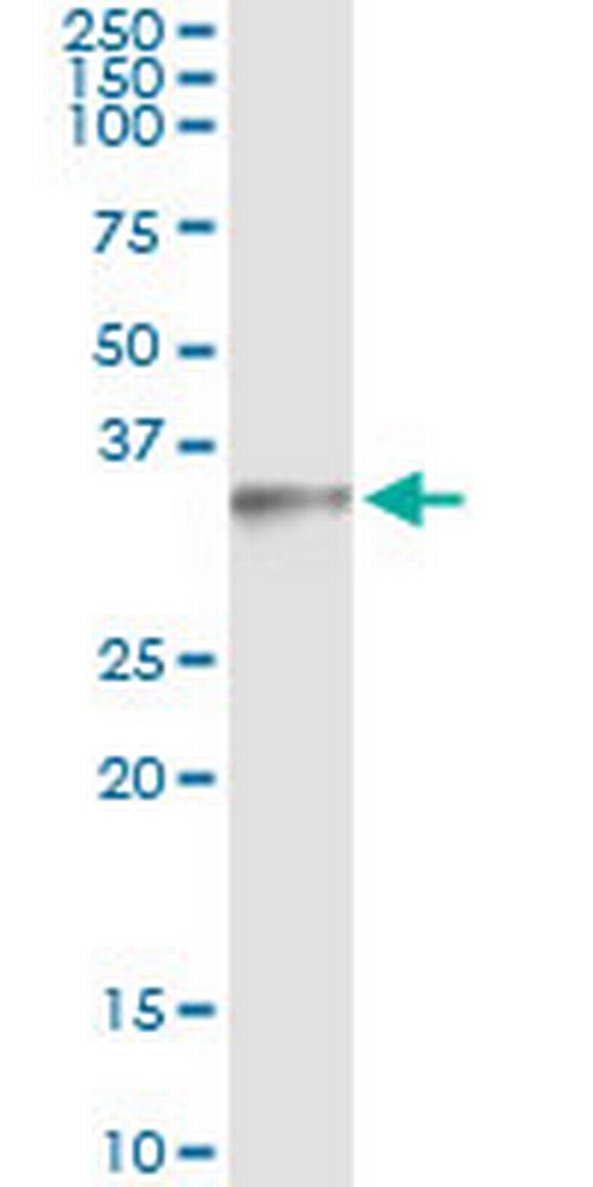 MAGEH1 Antibody in Immunoprecipitation (IP)