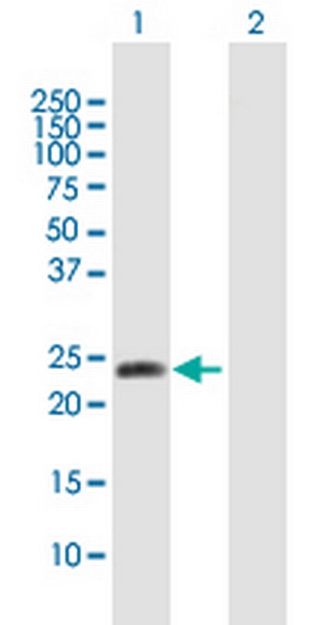 METTL11A Antibody in Western Blot (WB)