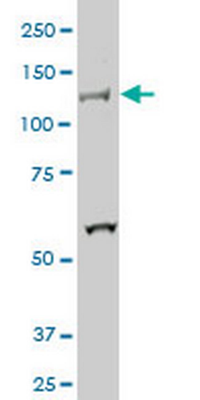 HIPK2 Antibody in Western Blot (WB)