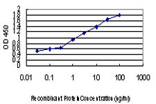 HIPK2 Antibody in ELISA (ELISA)