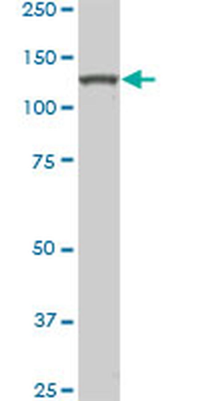 HIPK2 Antibody in Western Blot (WB)