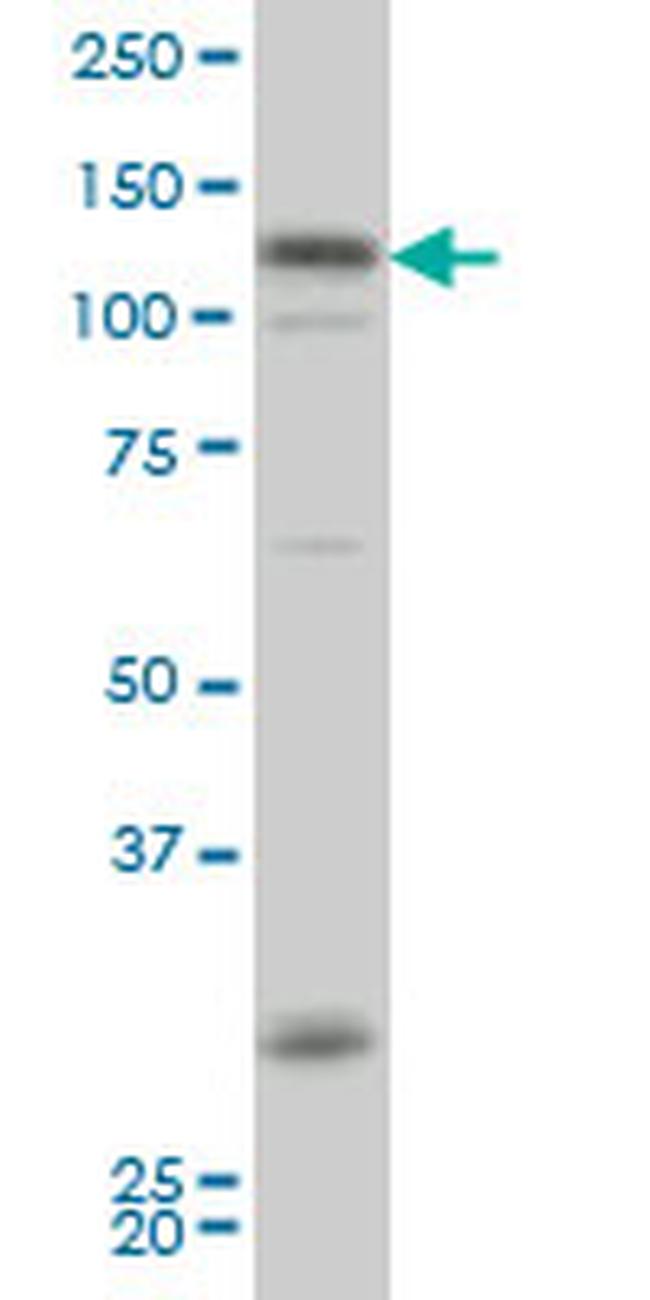 HIPK2 Antibody in Western Blot (WB)