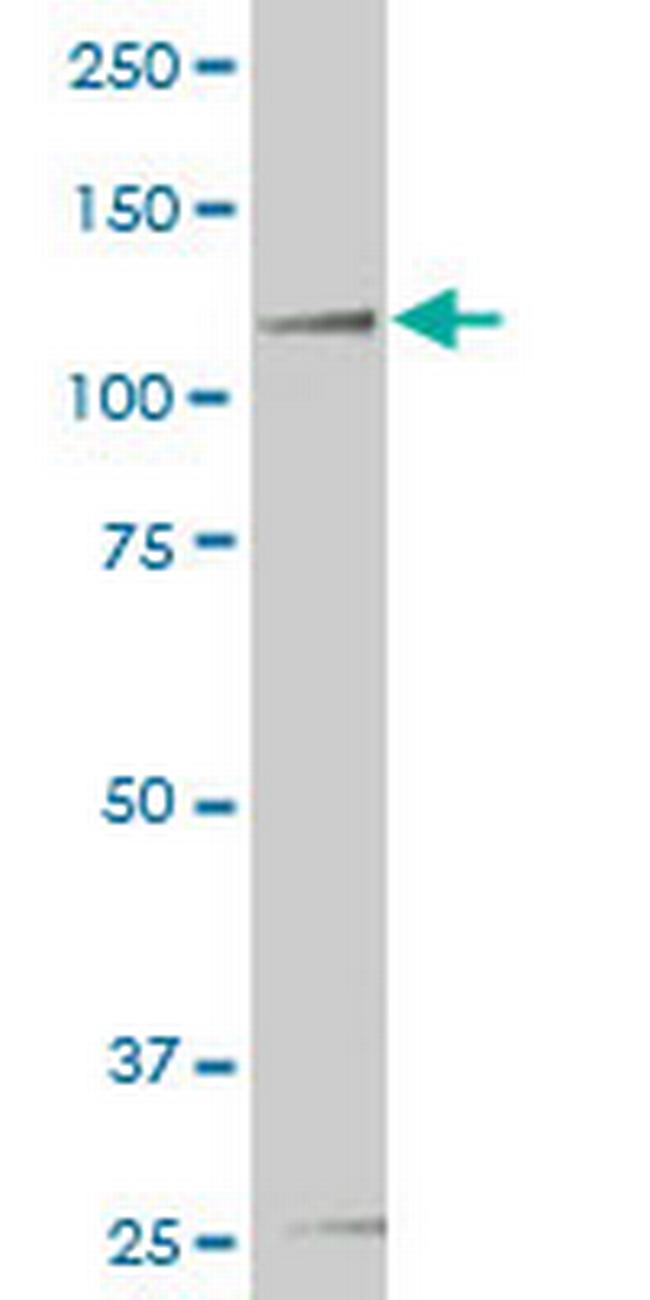 HIPK2 Antibody in Western Blot (WB)