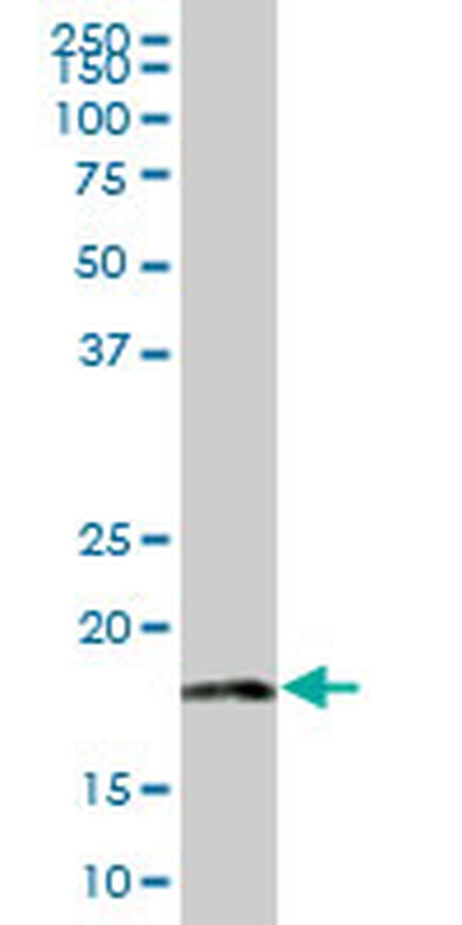 MRPL18 Antibody in Western Blot (WB)