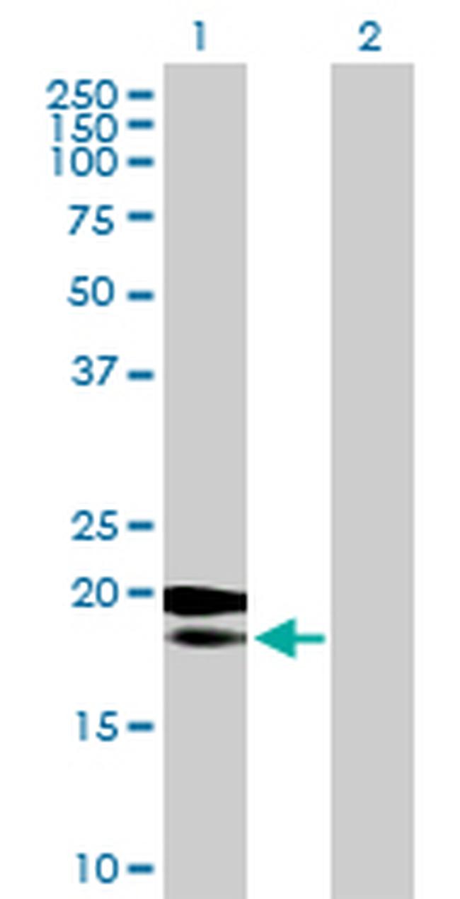 MRPL18 Antibody in Western Blot (WB)