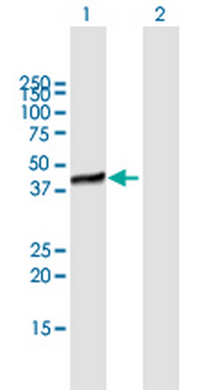 HSPC142 Antibody in Western Blot (WB)