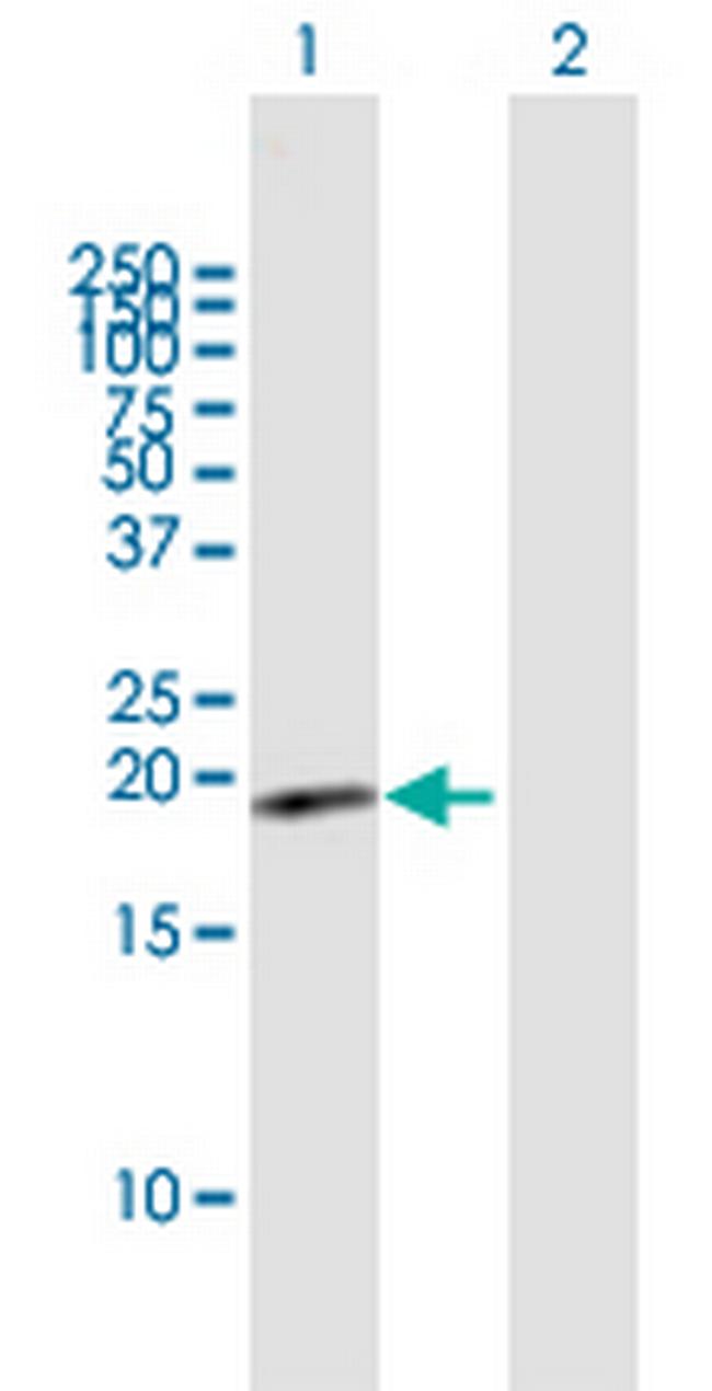 HSPC159 Antibody in Western Blot (WB)