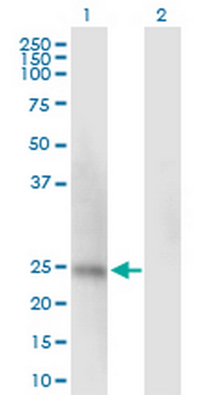 SSU72 Antibody in Western Blot (WB)