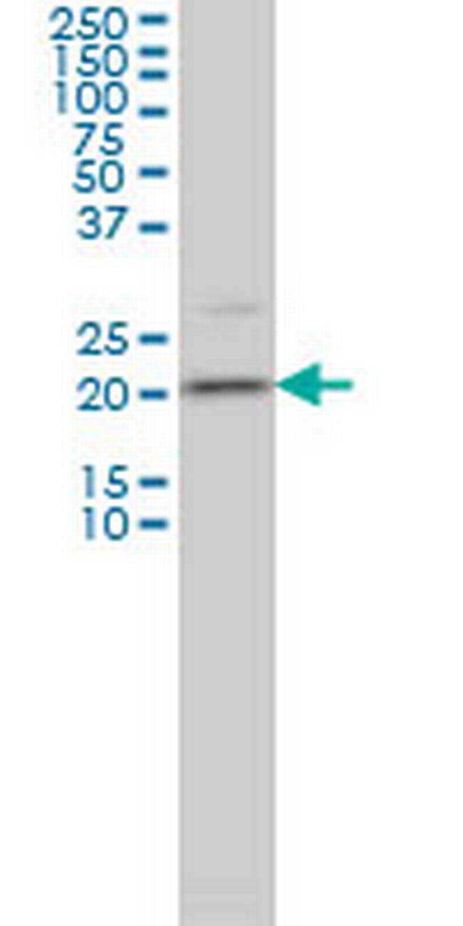 TAGLN3 Antibody in Western Blot (WB)