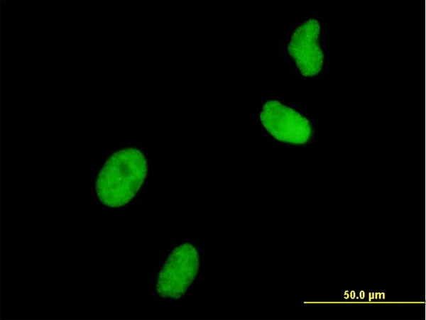 UHRF1 Antibody in Immunocytochemistry (ICC/IF)