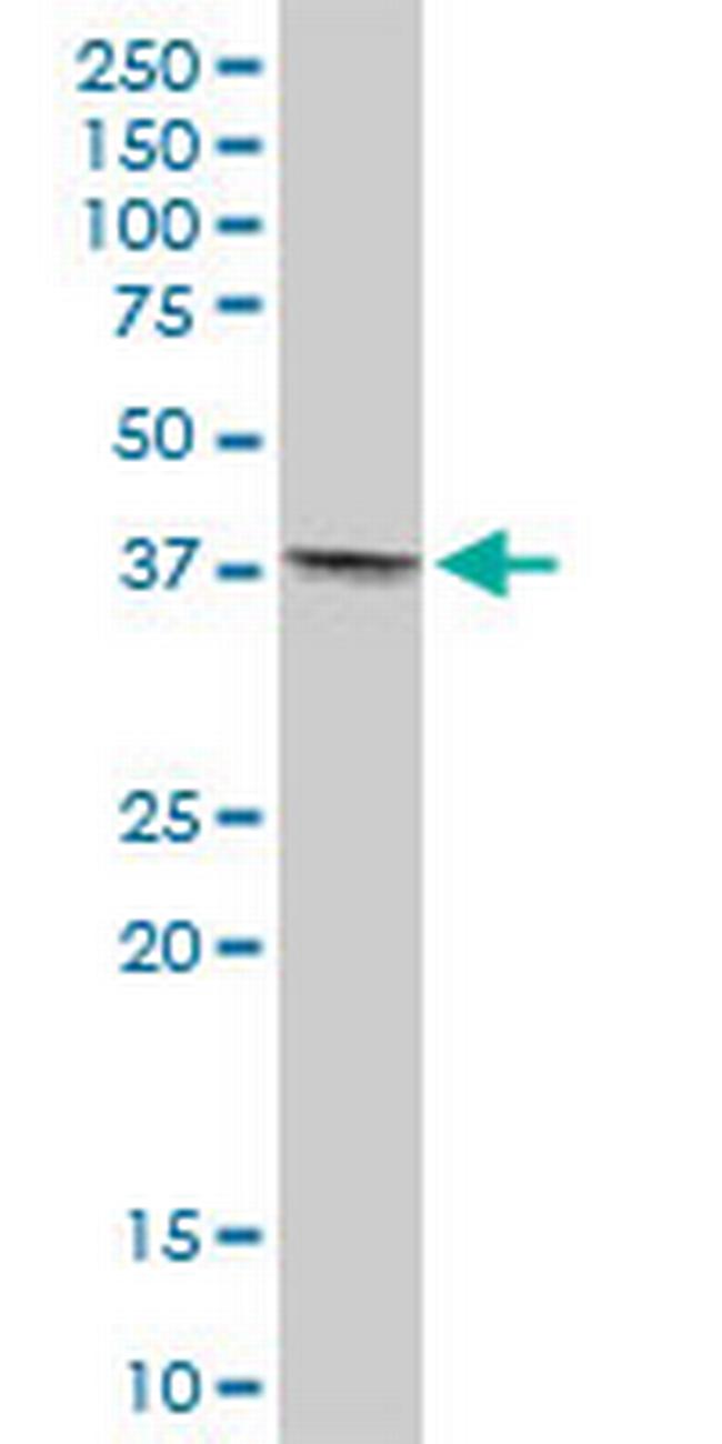 TMOD4 Antibody in Western Blot (WB)