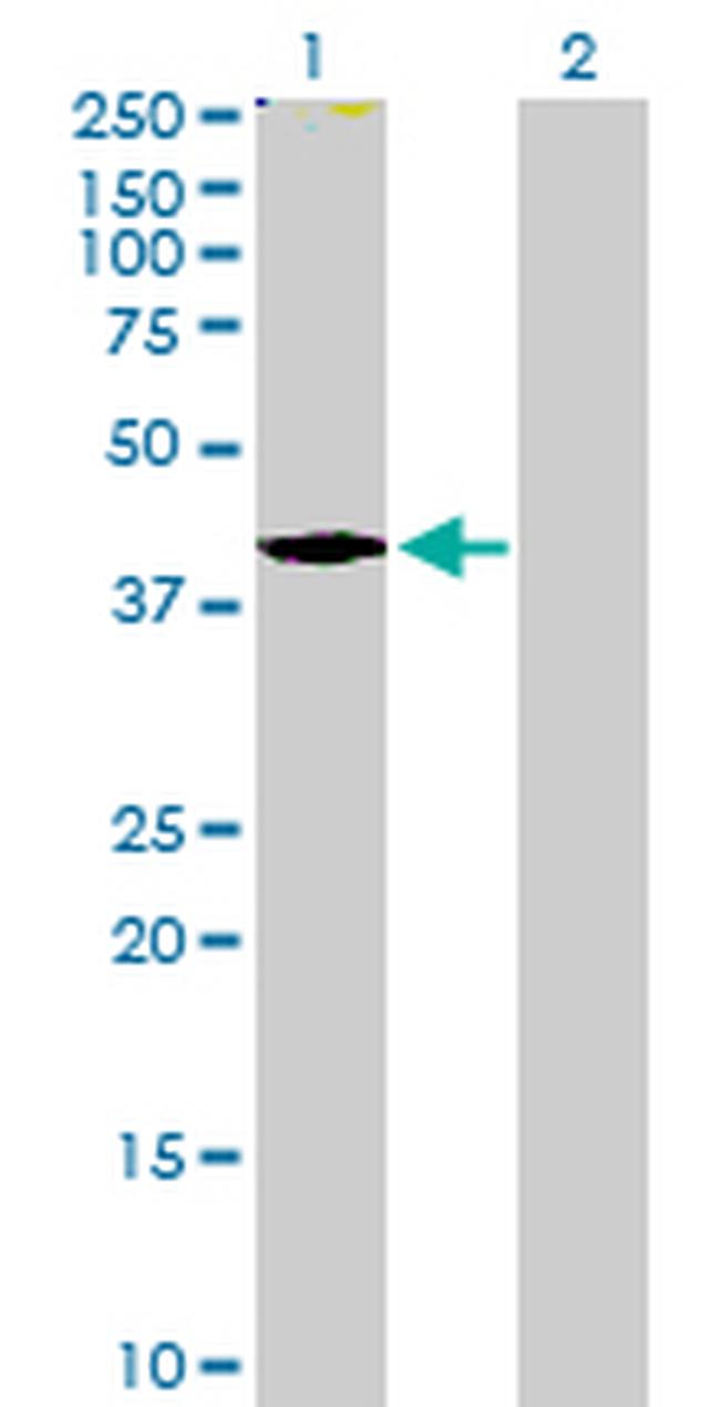 TMOD2 Antibody in Western Blot (WB)