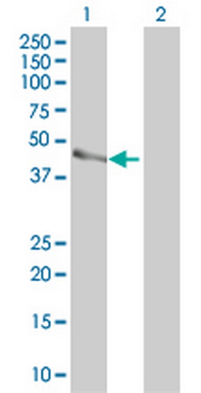 PARVB Antibody in Western Blot (WB)