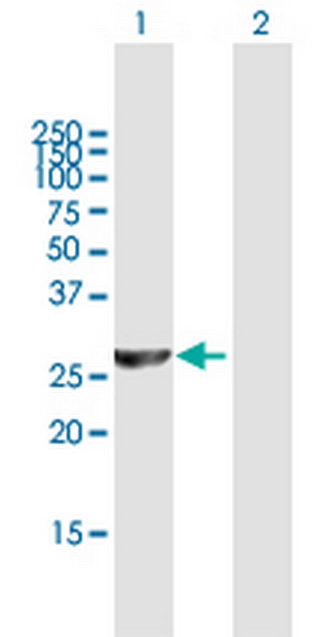 PSMC3IP Antibody in Western Blot (WB)