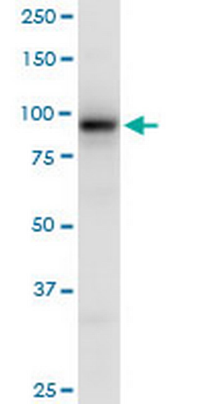 EEF2K Antibody in Western Blot (WB)